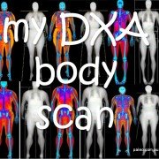 My DXA body scan dexa weight loss body fat-min