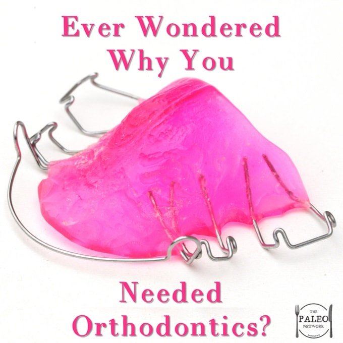 Ever wondered why you Needed Orthodontics paleo diet AHS Weston A Price-min